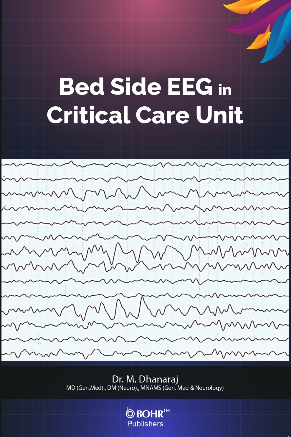 Bed Side EEG in Critical Care Unit